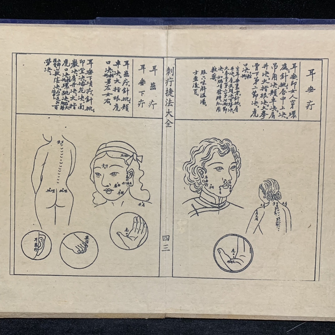 珍品 レア 清代 中国の漢方医薬書 線裝 全巻4 冊 『刺療放血圖方』 書巻セット」 医学書 中国古書 古文書 宣紙 唐本 中国古美術 漢籍 GF14_画像7