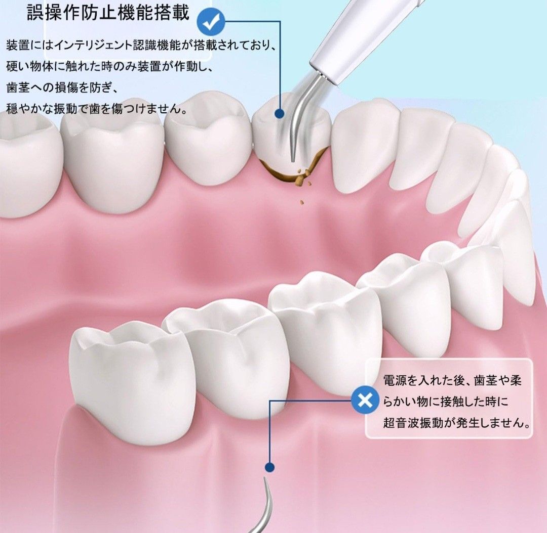 口腔洗浄器 超音波歯クリーナー 充電式 led 超音波振動 USB充電 歯石除去 口腔洗浄機