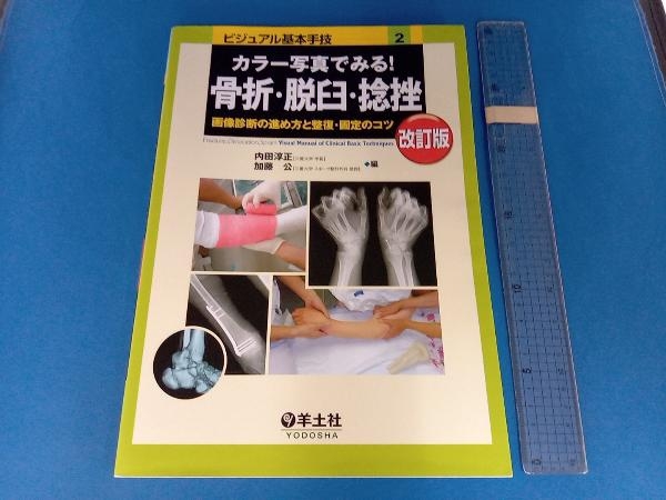 カラー写真でみる!骨折・脱臼・捻挫 改訂版 内田淳正_画像1