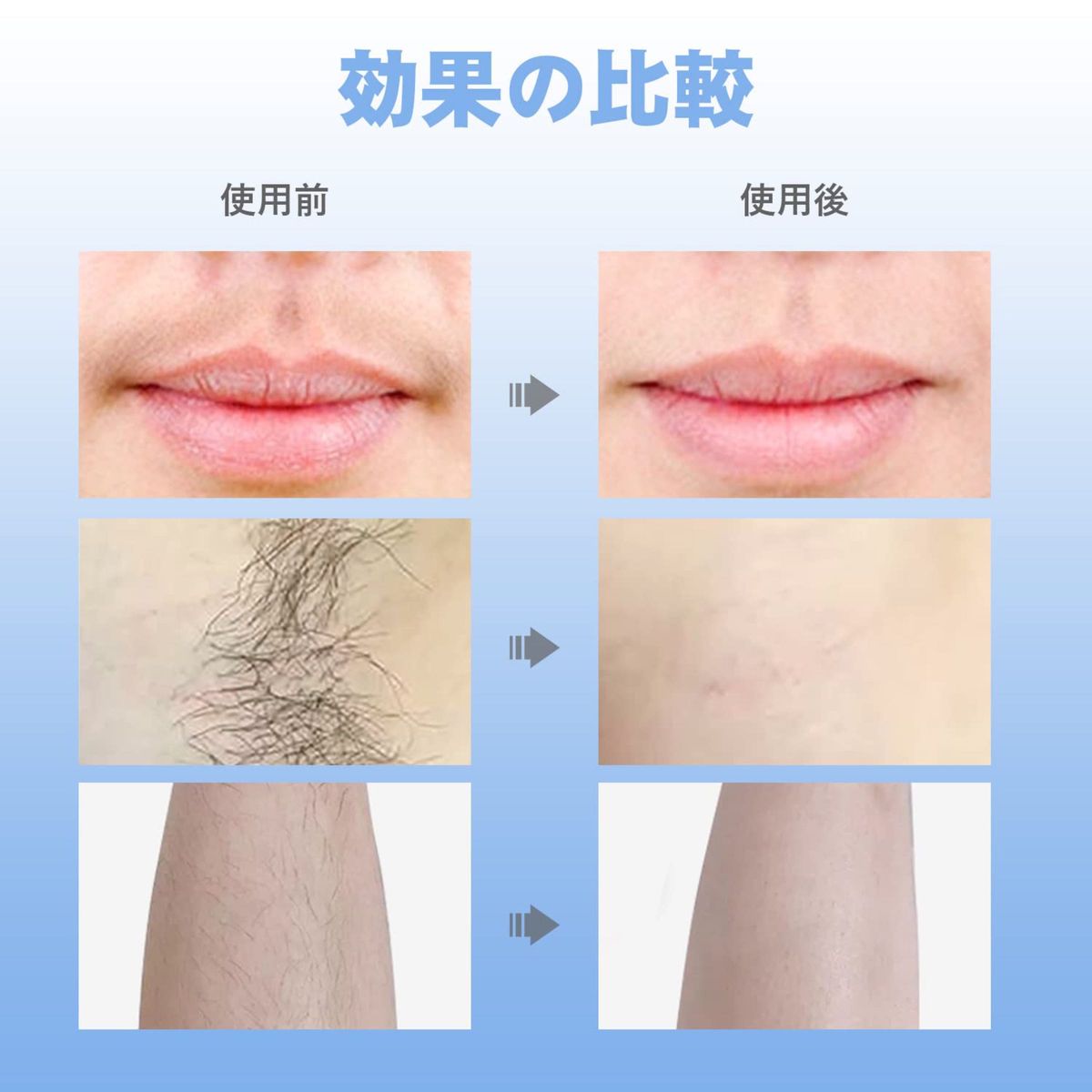 早い者勝ち 脱毛器 IPL脱毛器 レーザー脱毛器 vio対応 光 VIO 早い者勝ち 脱毛器 IPL脱毛器 レーザー脱毛器 vio対応 光 VIO