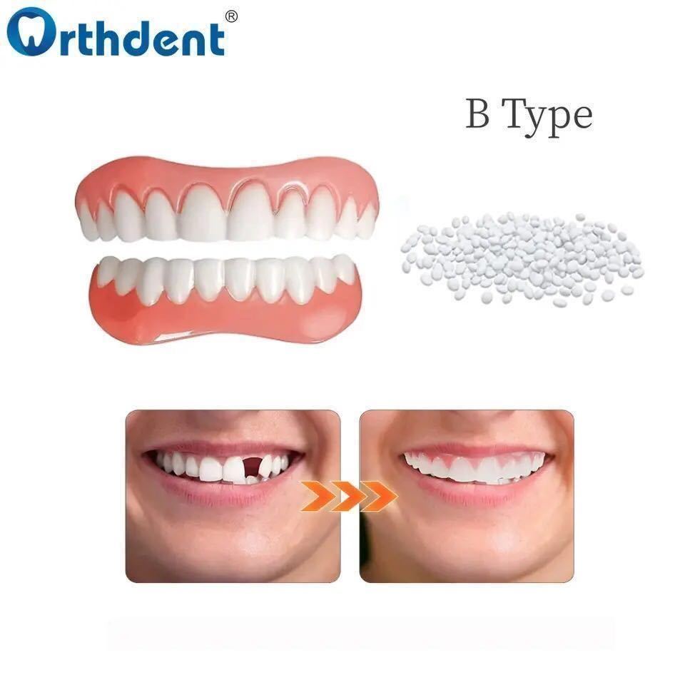 海外製 プラスチック義歯 上下セット 歯のカバー インスタントスマイル 仮歯 差し歯 入れ歯 付け歯　義歯 ワンタッチ装置 粘着ビーズ付 2_画像4