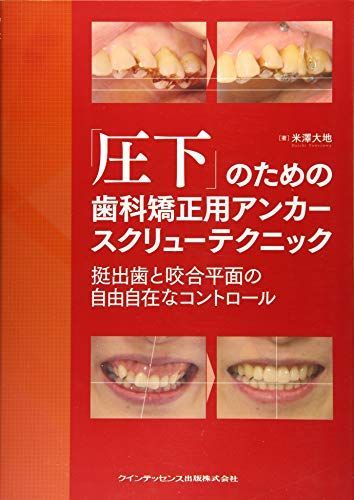 [A11823722]「圧下」のための歯科矯正用アンカースクリューテクニック 挺出歯と咬合平面の自由自在なコントロール
