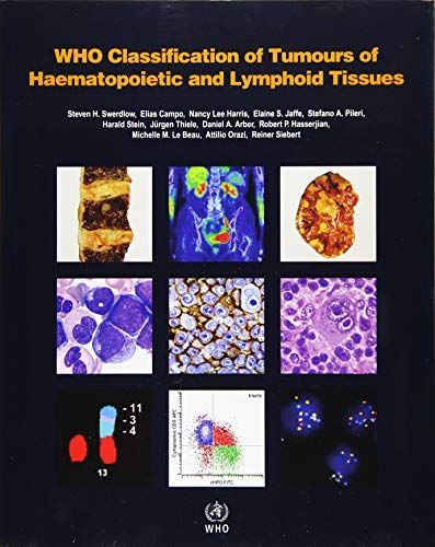 [A11494772]WHO Classification of Tumours of Haematopoietic and Lymphoid Tis