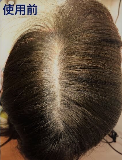 薄毛増毛ふりかけマイクロヘアーパウダー詰め替え用 色ダークブラウン：安心の純日本製パウダーを１００％使用！白髪隠し抜け毛ハゲかくしc_画像6