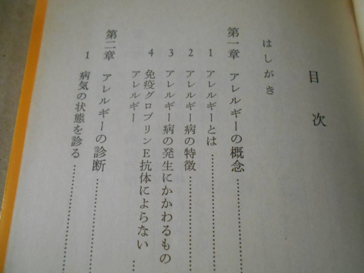 ◎アレルギーの話　矢田純一著　岩波新書　岩波書店　1985年発行　第１刷　中古　同梱歓迎　送料185円　_画像7