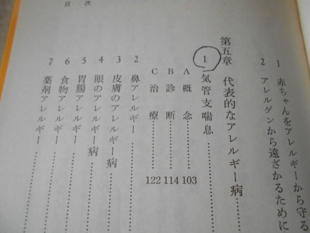 ◎アレルギーの話　矢田純一著　岩波新書　岩波書店　1985年発行　第１刷　中古　同梱歓迎　送料185円　_画像8