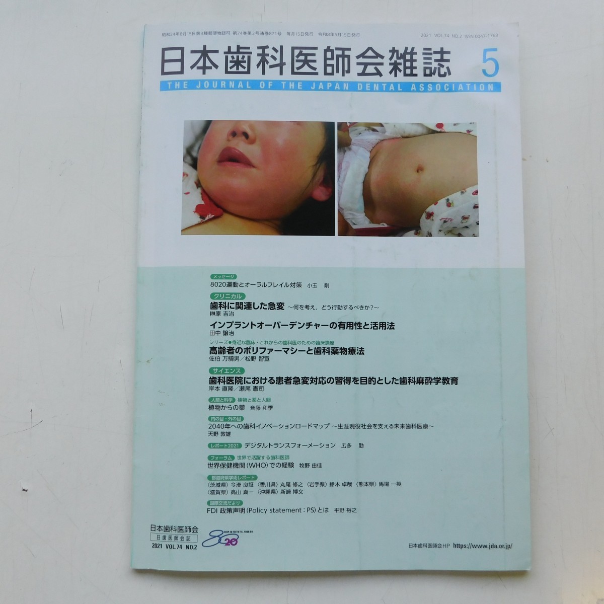 特2 53121 / 日本歯科医師会雑誌 2021年5月号 歯科に関連した急変 歯科医院における患者急変対応の習慣を目的とした歯科麻酔学教育_画像1