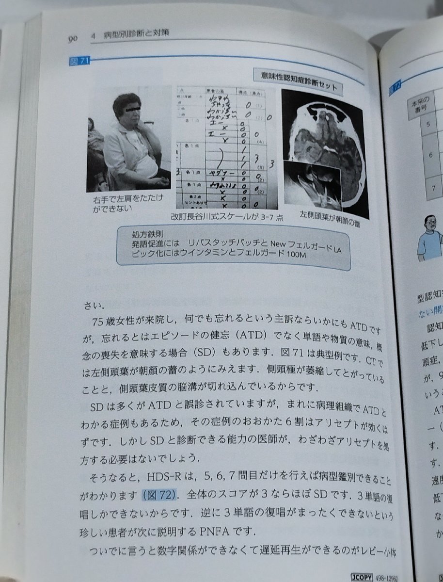 認知症治療のベストアンサー ～コウノメソッドによる王道処方～　河野和彦　中外医学社【ac01l】_画像6