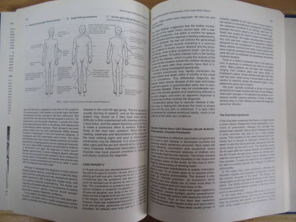 U58●【洋書】Neurological Differential Diagnosis 神経学的鑑別診断 2E JOHN PATTEN　ISBN 3540199373 医学書 ※表紙カバー欠品 230309_画像9