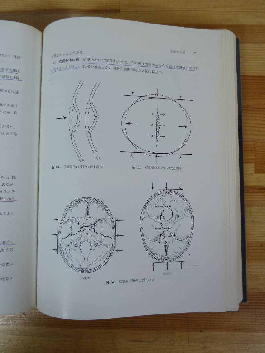 T73▽法医学診断 錫谷徹 死亡診断書書き方付き 南江堂 函入り 死因論 死体現象 自然的急死 損傷 交通事故 飢餓 窒息 親子鑑別 231220_画像9