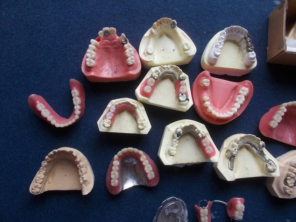 昭和レトロ　総義歯　見本　義歯　入れ歯　サンプル　模型　フルデンチャー　歯科医　技巧　古道具　古物_画像3