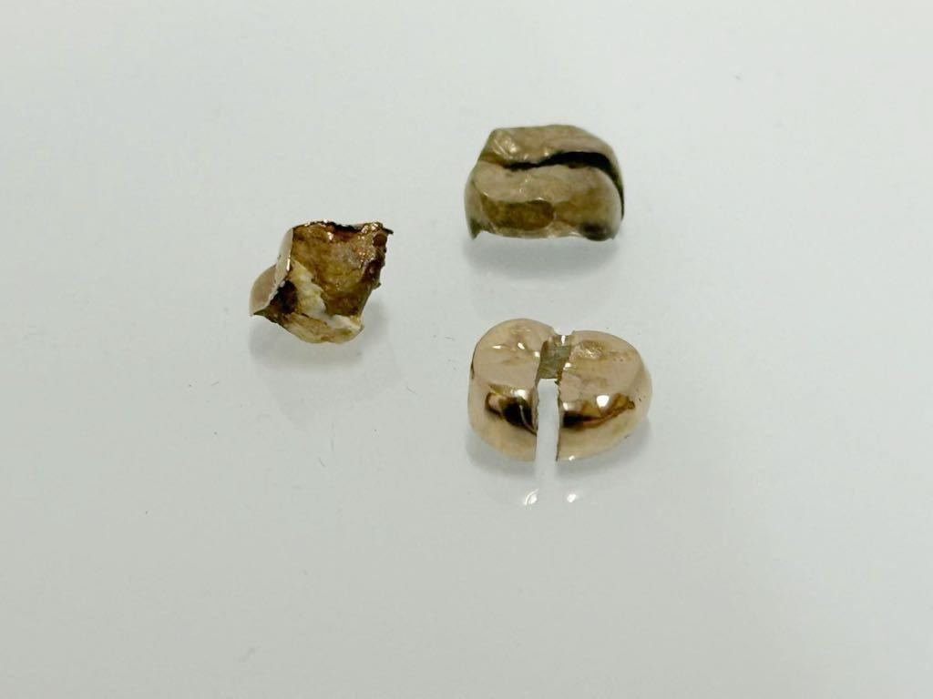 1円スタート / 金歯 金 歯科金属 除去冠 被せ物 5.74g_画像3