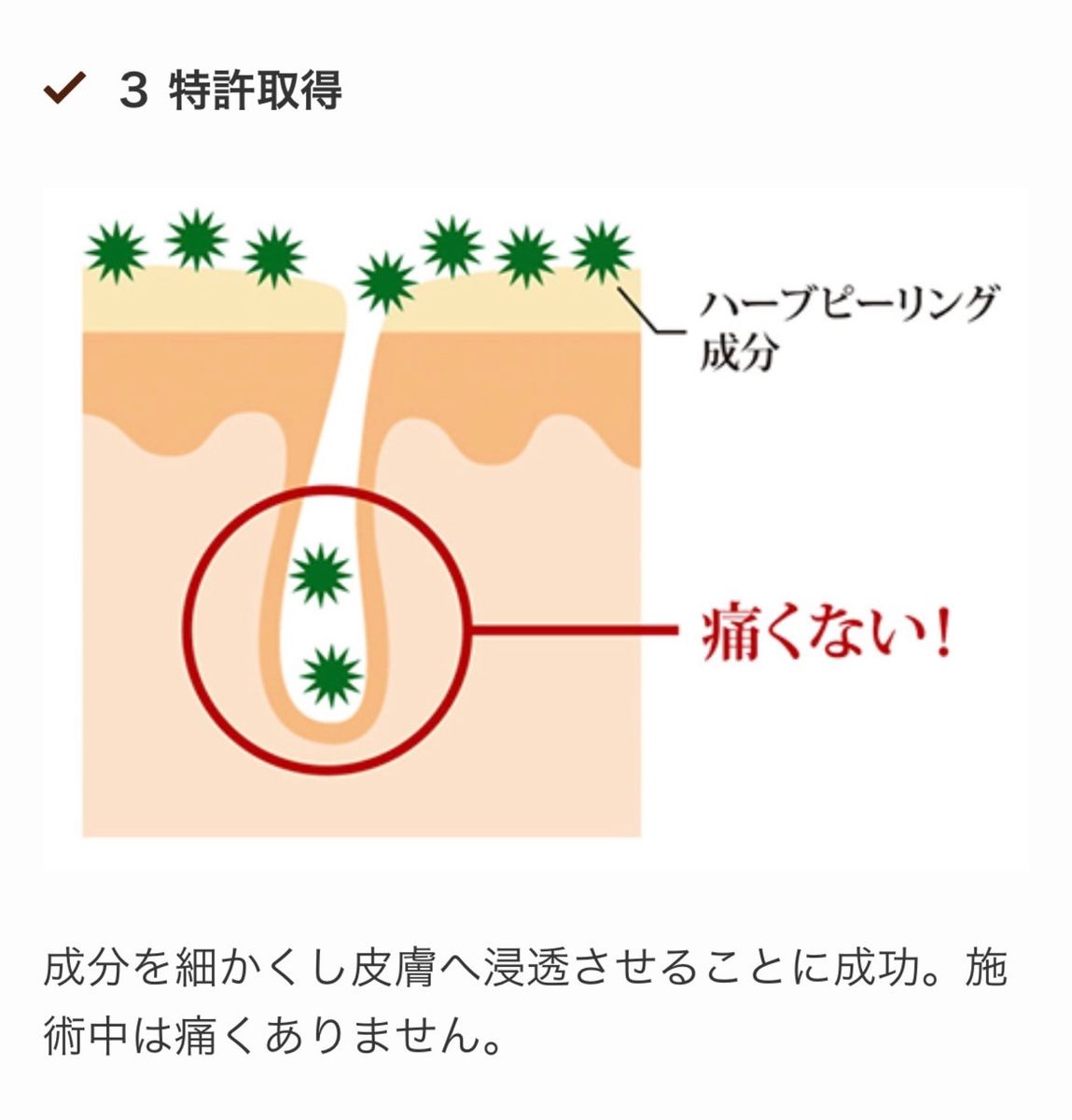 ◎説明書付◎ OHLハーブピーリング　ホームケア3回分　☆ルシェリ酵素洗顔付き！