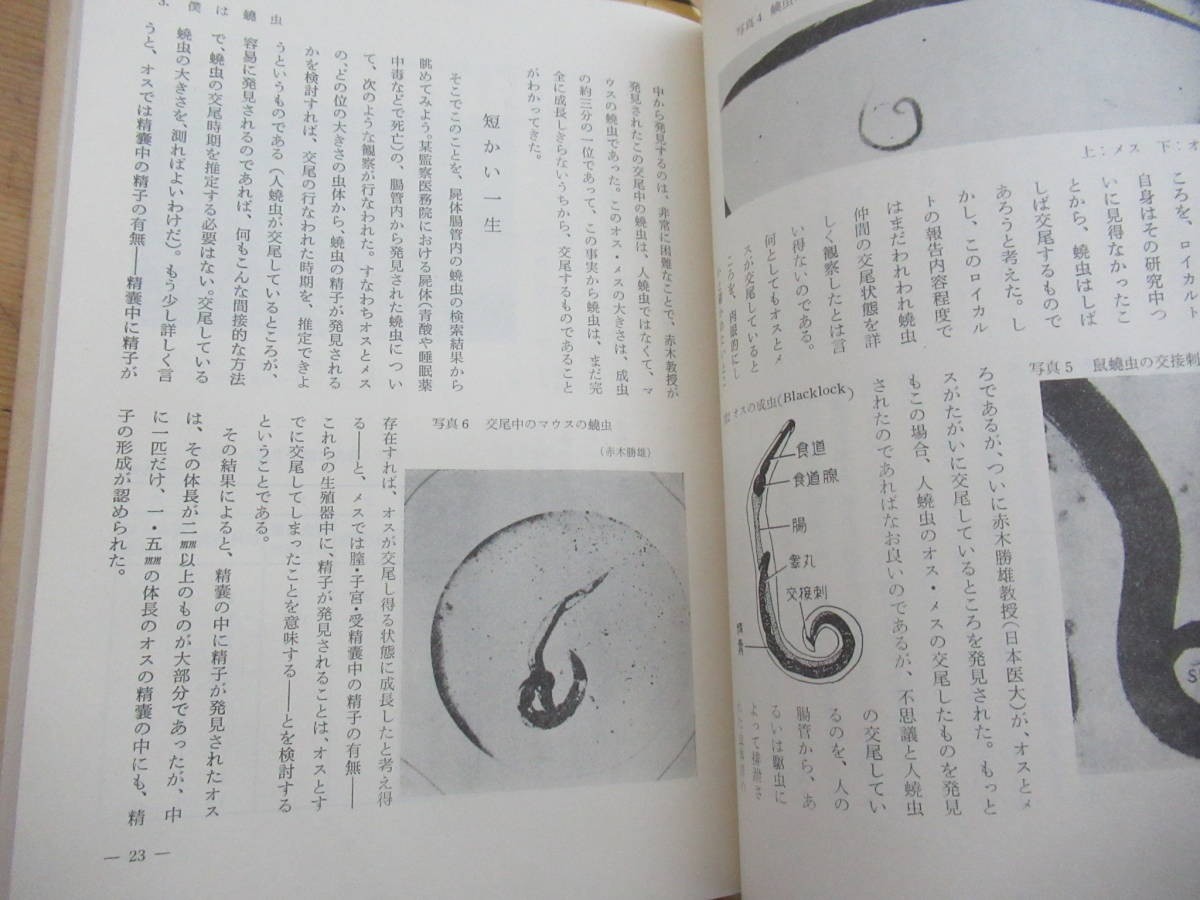 r09〇 希少 『 鉤虫の探検 + 蟯虫の探検 整体と対策 2冊セット 』水野哲夫 昭和50年 青村出版社 菊屋書房 日本寄生虫予防会 寄生中 231218_画像8