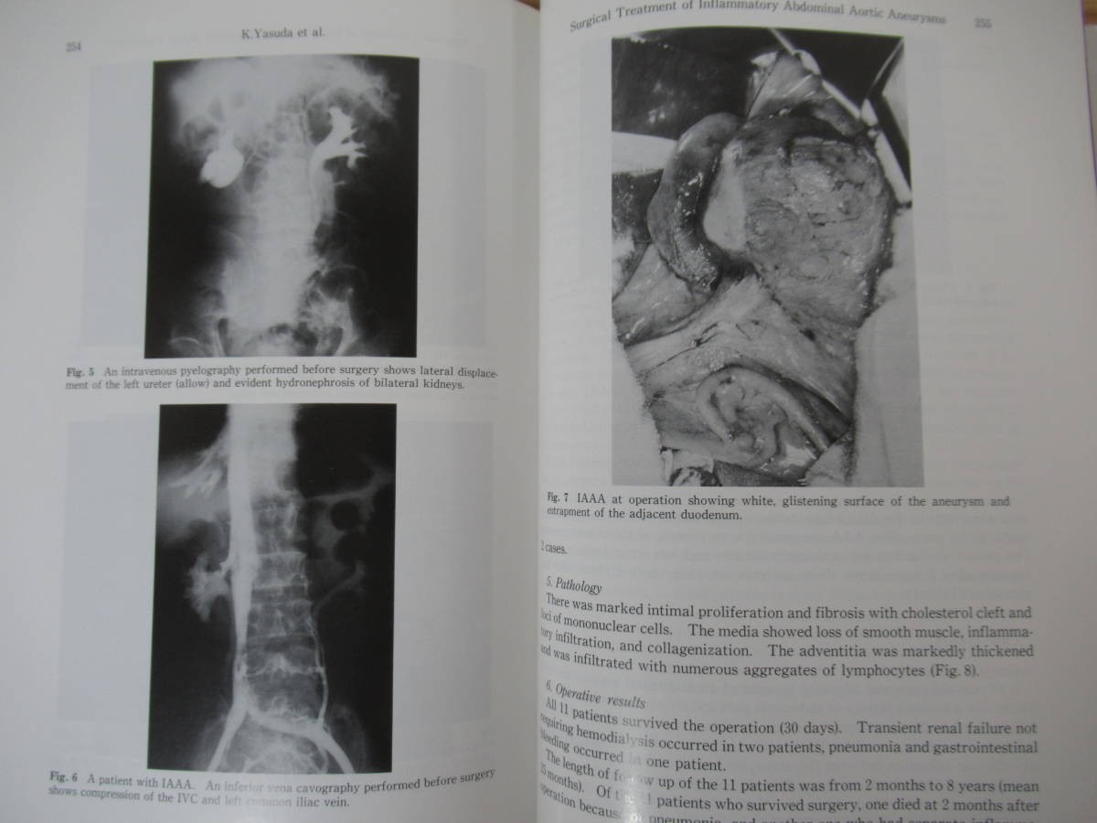 L92●Intractable vasculitis syndromes 田辺達三 北海道大学出版会 1993年 難治性血管炎 病理学 免疫学 臨床 国際シンポジウム 230302_画像9