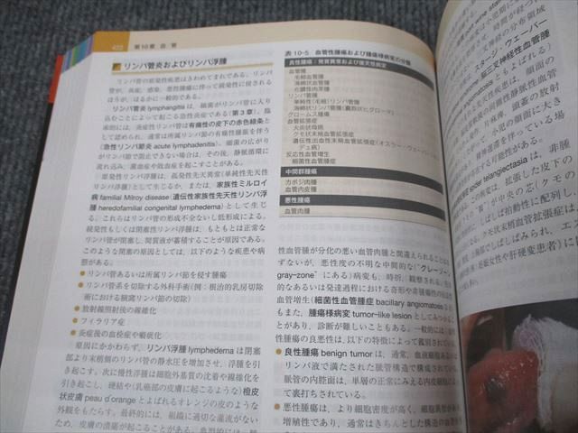 VO94-004 ELSEVIER ロビンス基礎病理学 原書10版 2011 37M3D - 医療関連資格 VO94-004 ELSEVIER ロビンス基礎病理学 原書10版 2011 37M3D - 医療関連資格