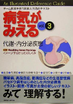 病気がみえる　代謝・内分泌疾患　第１版(ｖｏｌ．３)／医療情報科学研究所(編者)_画像1