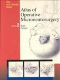 [A12192545]Atlas of Operative Microneurosurgery: Brain Tumors， Volume 2 Tew_画像1