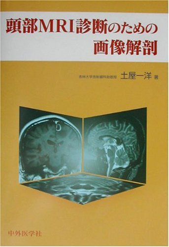 [A01231505]頭部MRI診断のための画像解剖 土屋 一洋_画像1