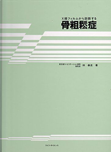 [A12076439]X線フィルムから診断する骨粗鬆症 林 〓史_画像1