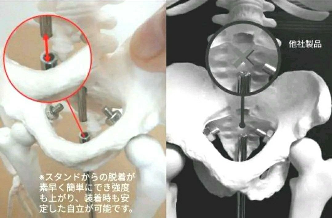 人体骨格模型 45cm 1/4モデル 肩関節が自由に動かせる