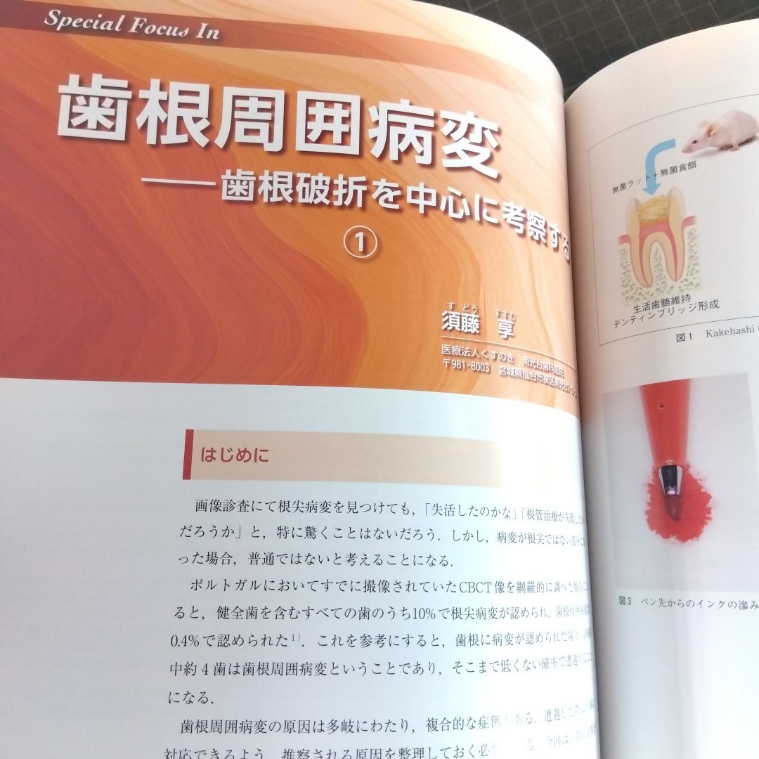 日本歯科評論　2023年7月号　 究極の歯髄保存――診療ガイドラインから考える深在性う蝕への臨床対応_画像7