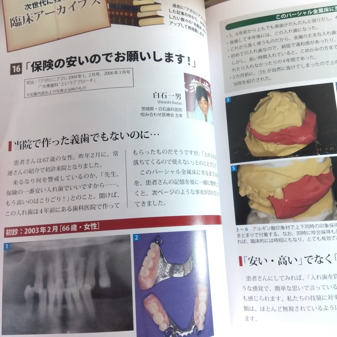 アポロニア21　2024年1月号　「歯科衛生士力」の可能性　治療の幅や質が変わる！_画像5