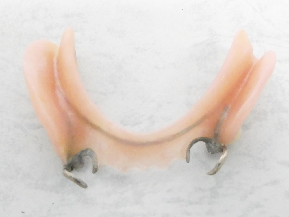 02 00-584206-96 [Y] 歯 歯科金属 義歯 入れ歯 オーラルケア 重さ:約42g 旭00_画像3
