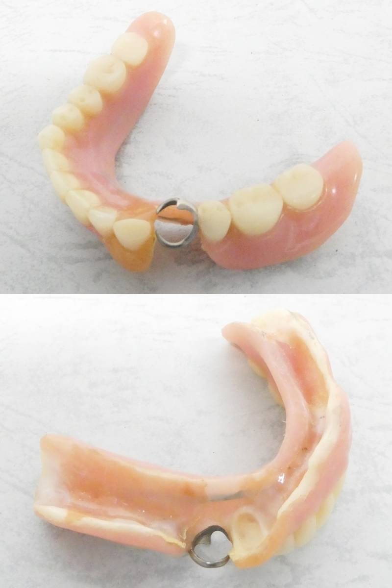02 00-584206-96 [Y] 歯 歯科金属 義歯 入れ歯 オーラルケア 重さ:約42g 旭00_画像8