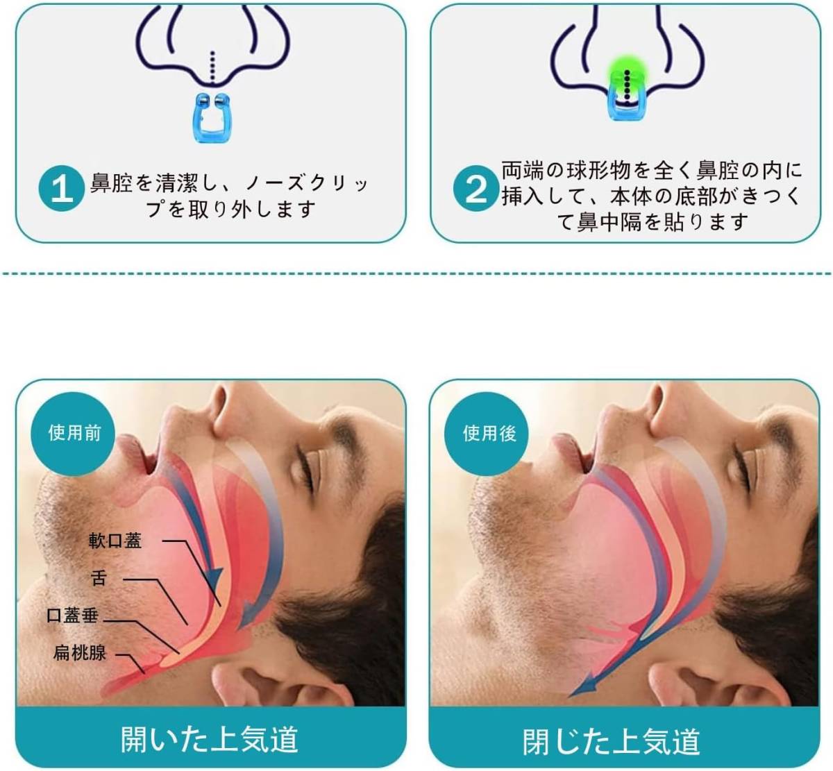 【 6個セット】いびき防止グッズ いびき対策 いびき 防止 ノーズクリップ 鼾防止グッズ いびき改善グッズ 鼻呼吸クリップ いびき鼻孔拡張_画像4