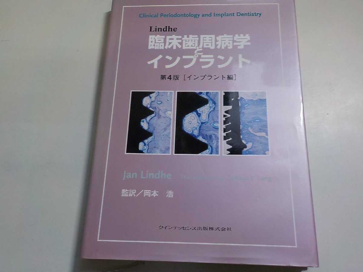 20V1878◆Lindhe 臨床歯周病学とインプラント 第4版[インプラント編] ▽の画像1