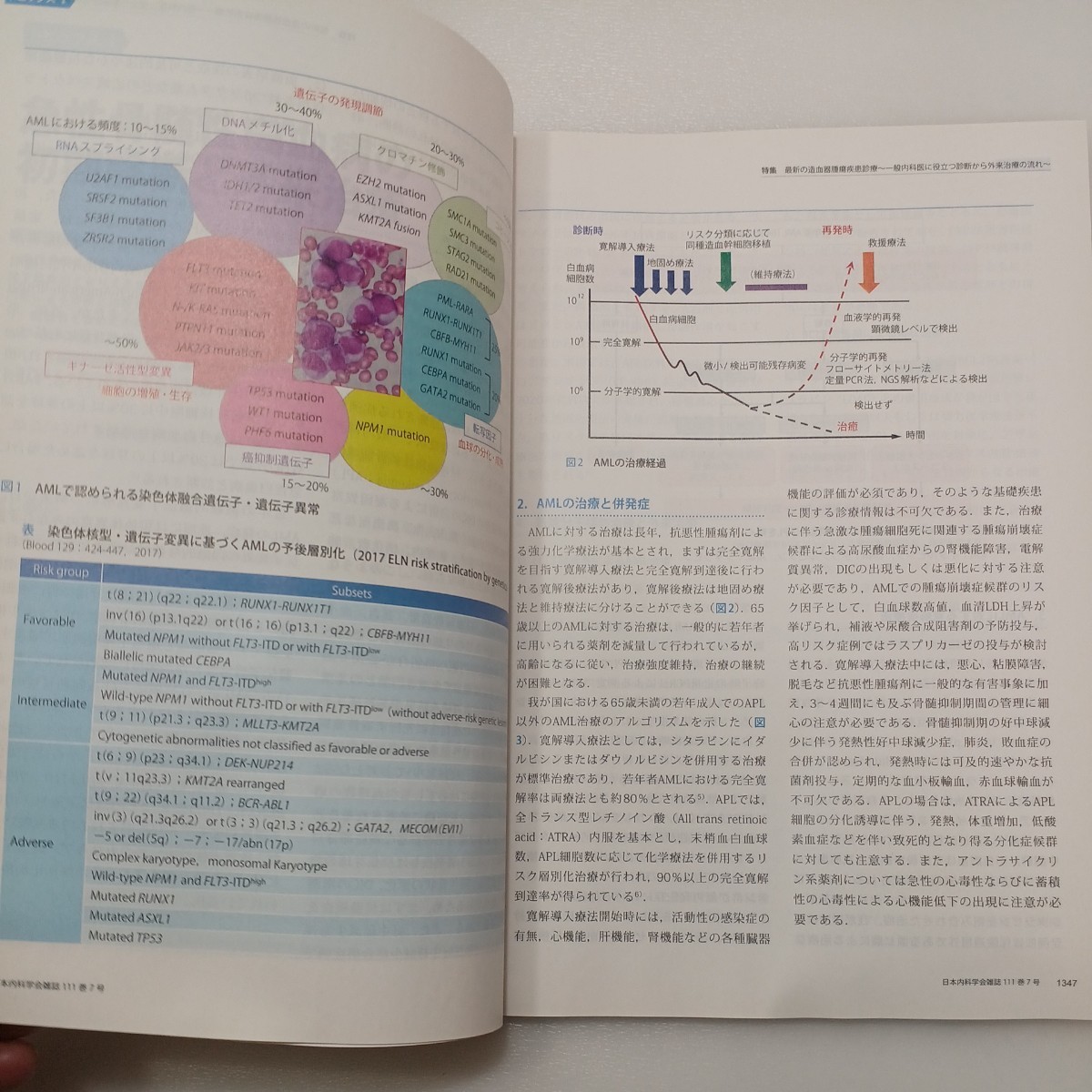 zaa-540♪日本内科学会雑誌 第111巻第7号 2022年7月 特集:最新の造血器腫瘍疾患診療～一般内科医に役立つ診断から外来治療の流れ～_画像6