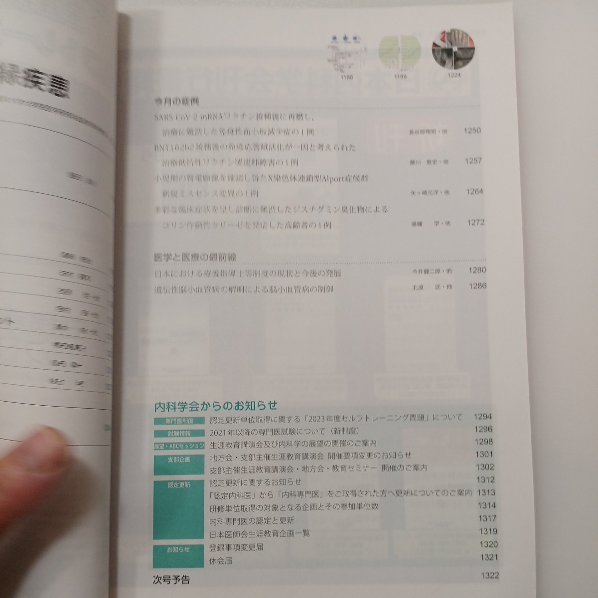 zaa-540♪日本内科学会雑誌 第112巻第7号 2023年7月 特集: 多発性骨髄腫と類縁疾患