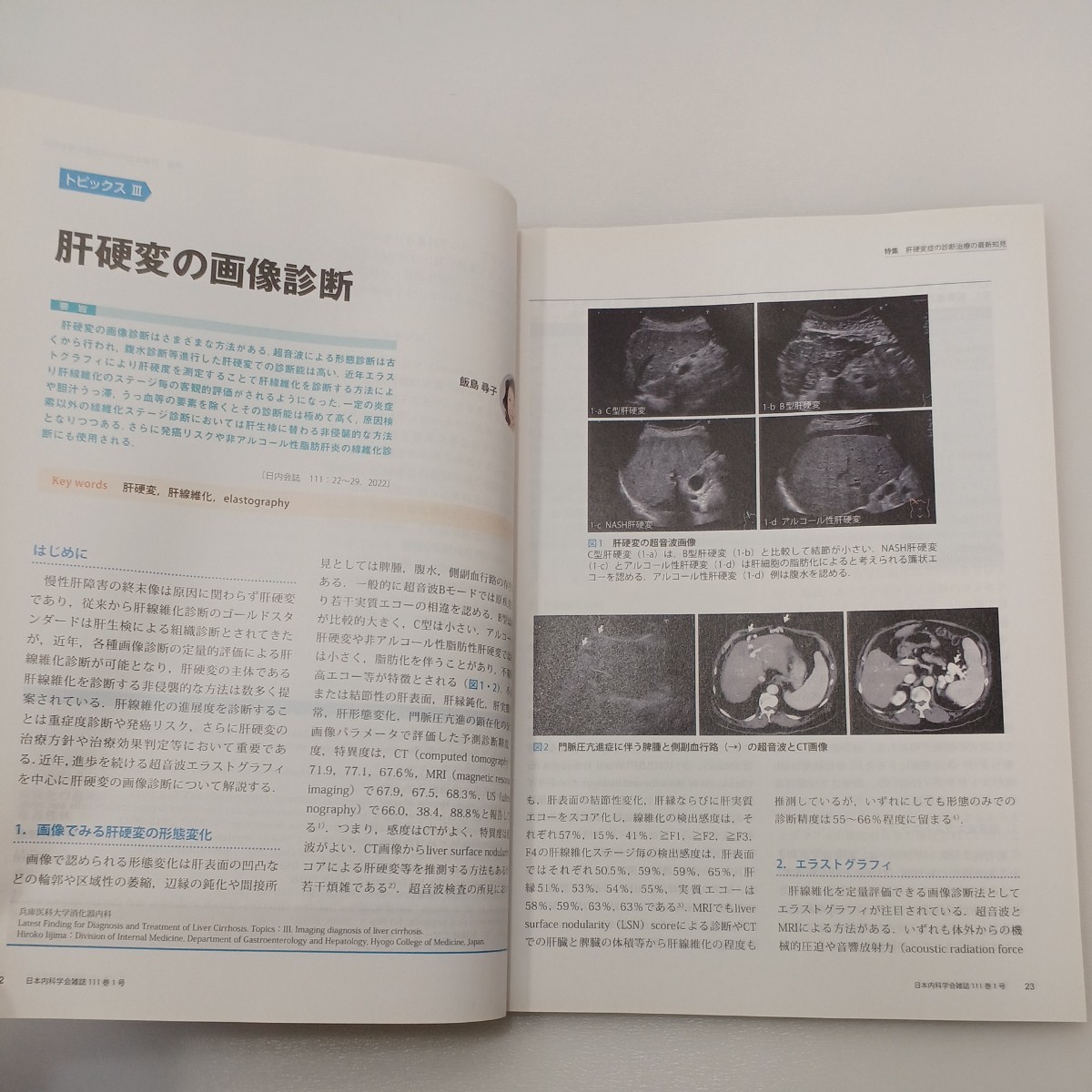 zaa-541♪日本内科学会雑誌 第111巻第4号 2022年1月 特集:肝硬変症の診断治療の最新知見