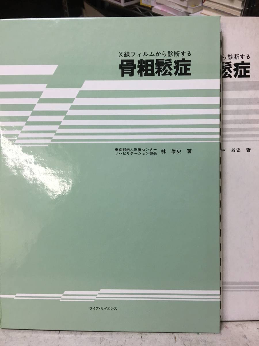 即決　X線フィルムから診断する骨粗鬆症　林 二史_画像2