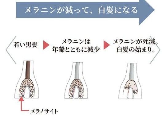 エルゴン　エイジングスカルプケア　白髪ケア　２点セット　(シャンプー&ローション頭皮用美容液)