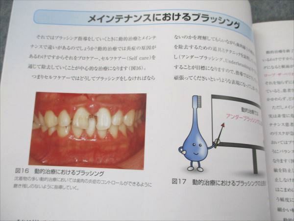 VS19-130 松風 Dr.Hiroのペリオな気分でメインメンテナンス 2006 山本浩正 08S3Cの画像4