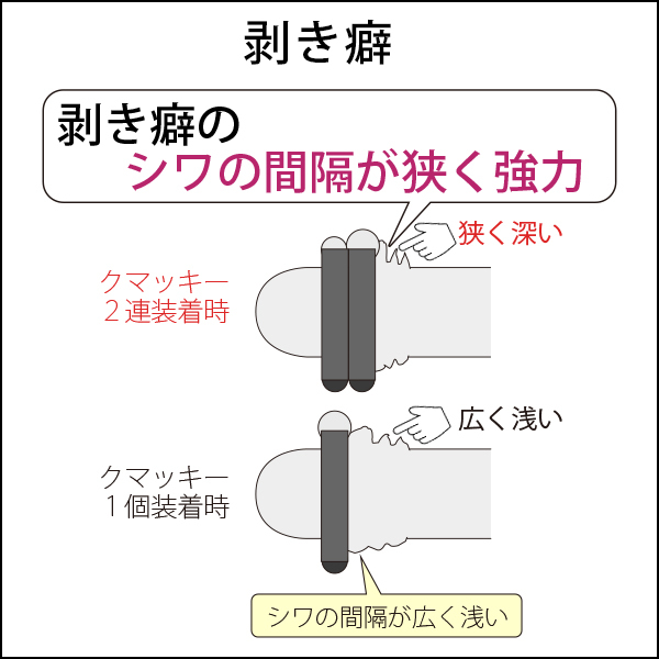 ペニス牽引リング クマッキーウェイト３００ ＣＲ ブラック 増大ストレッチ器具（増減用錘・落下防止器具無）