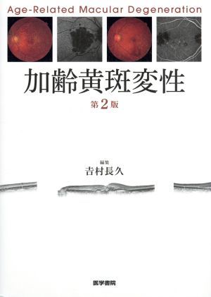 加齢黄斑変性　第２版 日本人の加齢黄斑変性の本質に迫る決定版書籍／吉村長久(著者),赤木由美子(著者)_画像1