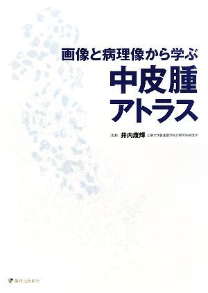 画像と病理像から学ぶ中皮腫アトラス／井内康輝【監修】
