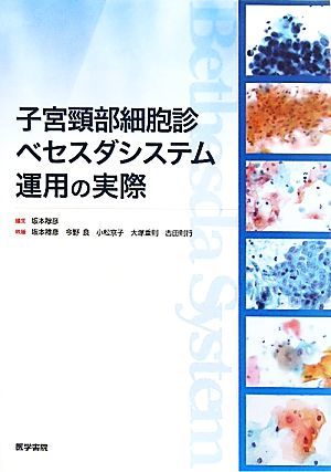 子宮頸部細胞診ベセスダシステム運用の実際／坂本穆彦【編・著】，今野良，小松京子，大塚重則，古田則行【著】_画像1