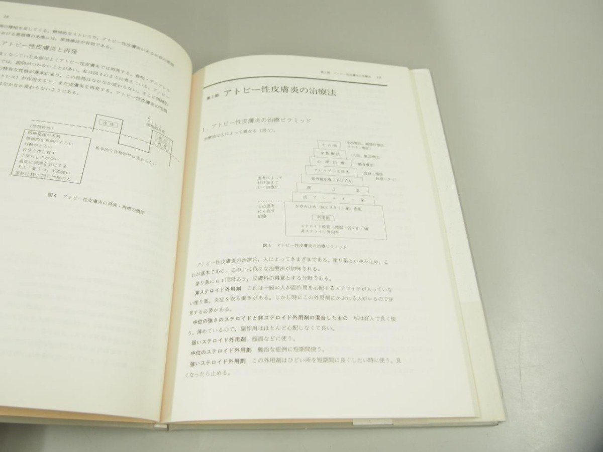 ★　【アトピー性皮膚炎の漢方治療　疾患別臨床シリーズ2　現代出版プランニング 1990年】151-02401_画像4