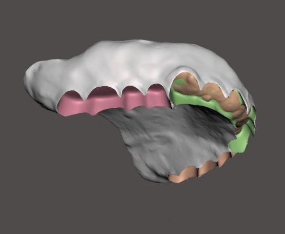 歯科　歯科技工　義歯スキャンデータからコピーデンチャーのデータ製作　義歯データからのモデルデータ製作手順動画　mp4_画像6