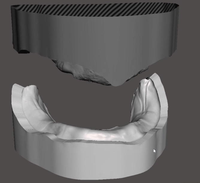 歯科　歯科技工　義歯スキャンデータからコピーデンチャーのデータ製作　義歯データからのモデルデータ製作手順動画　mp4_画像10