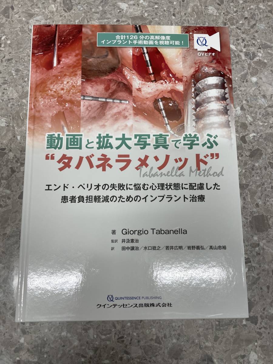 動画と拡大写真で学ぶ"タバネラメソッド" エンド・ペリオの失敗に悩む心理状態に_表紙写真