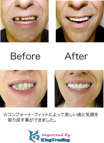 素敵な歯、笑顔をあなたに!