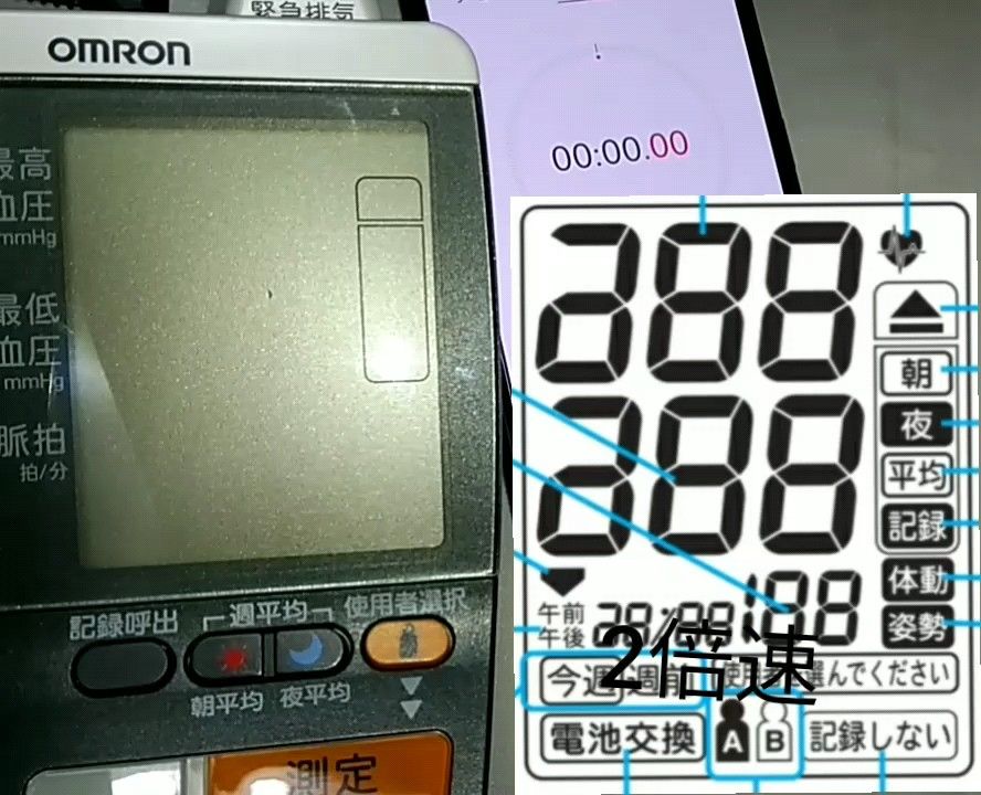 動作動画あり 高血圧管理 OMRON オムロン HEM-1010 自動電子 血圧計 アームイン 上腕式 スポットアーム