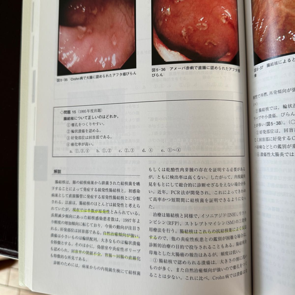 日本消化器内視鏡学会専門医学術試験問題 解答と解説第2版第4版第5版、消化器内視鏡ハンドブック