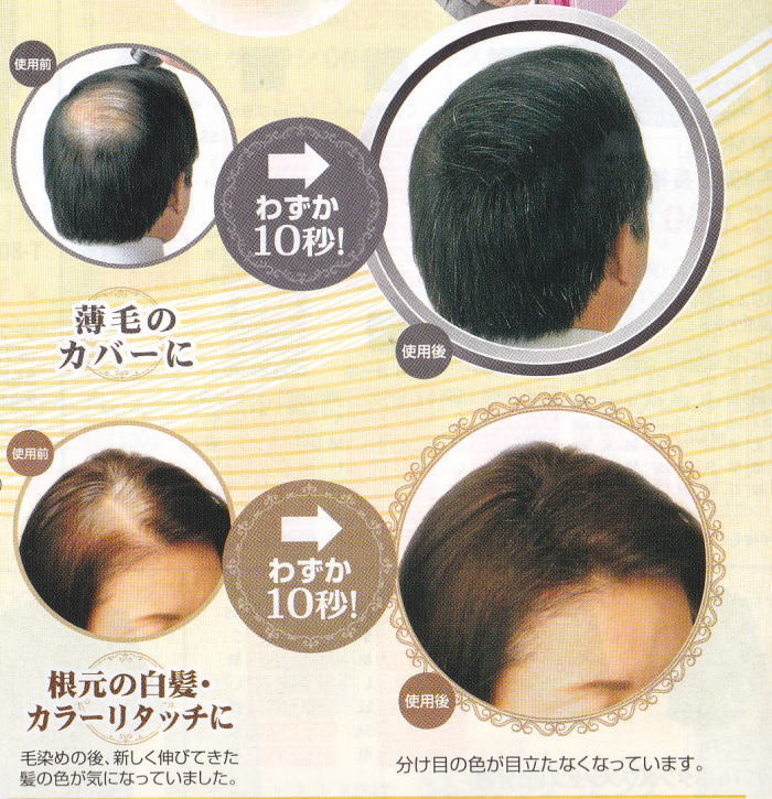 B)送無　ＴＶで話題の商品　スーパーミリオンヘアー ブラック25g_画像4