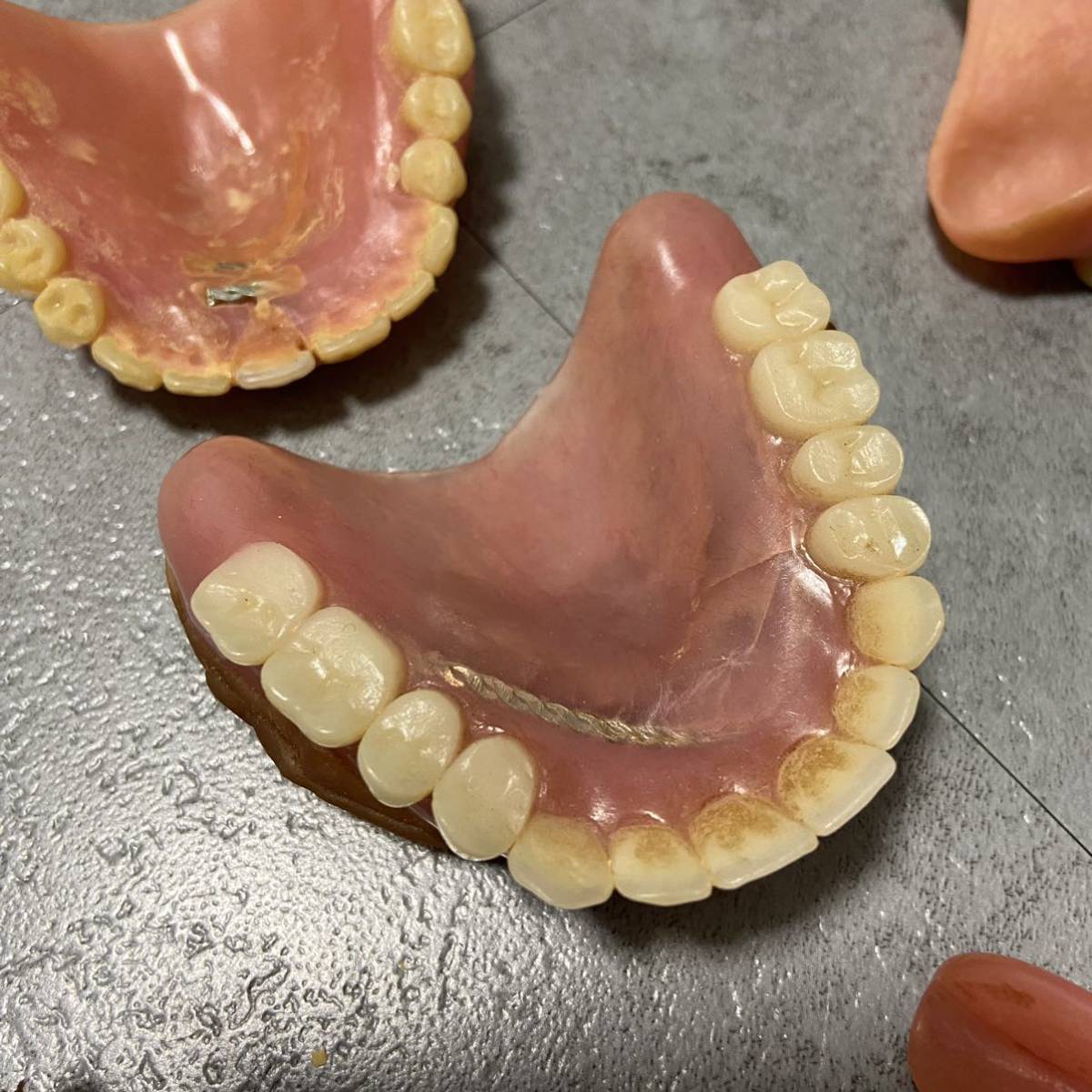 入れ歯　まとめ　義歯　銀歯　等　パラジウム　冠　歯科材　重さ　約72g_画像5